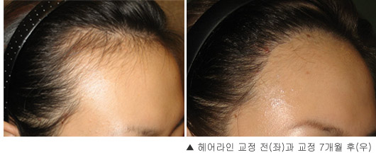 1cm 헤어 이미지
