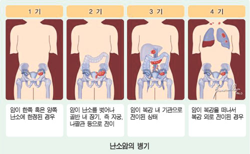 http://m.blog.daum.net/_blog/_m/articleView.do?blogid=086bJ&articleno=13614528 Daum 블로그